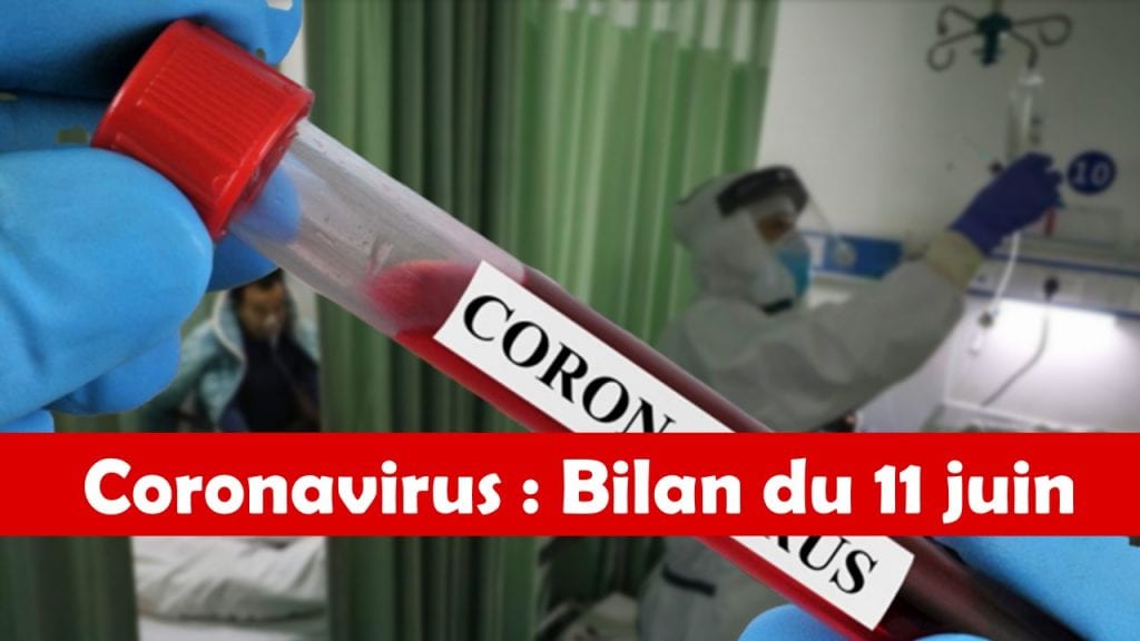 Bilan coronavirus du 11 juin : les guérisons repartent à la hausse