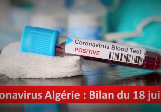 Bilan coronavirus du 18 juillet : Les guérisons en hausse
