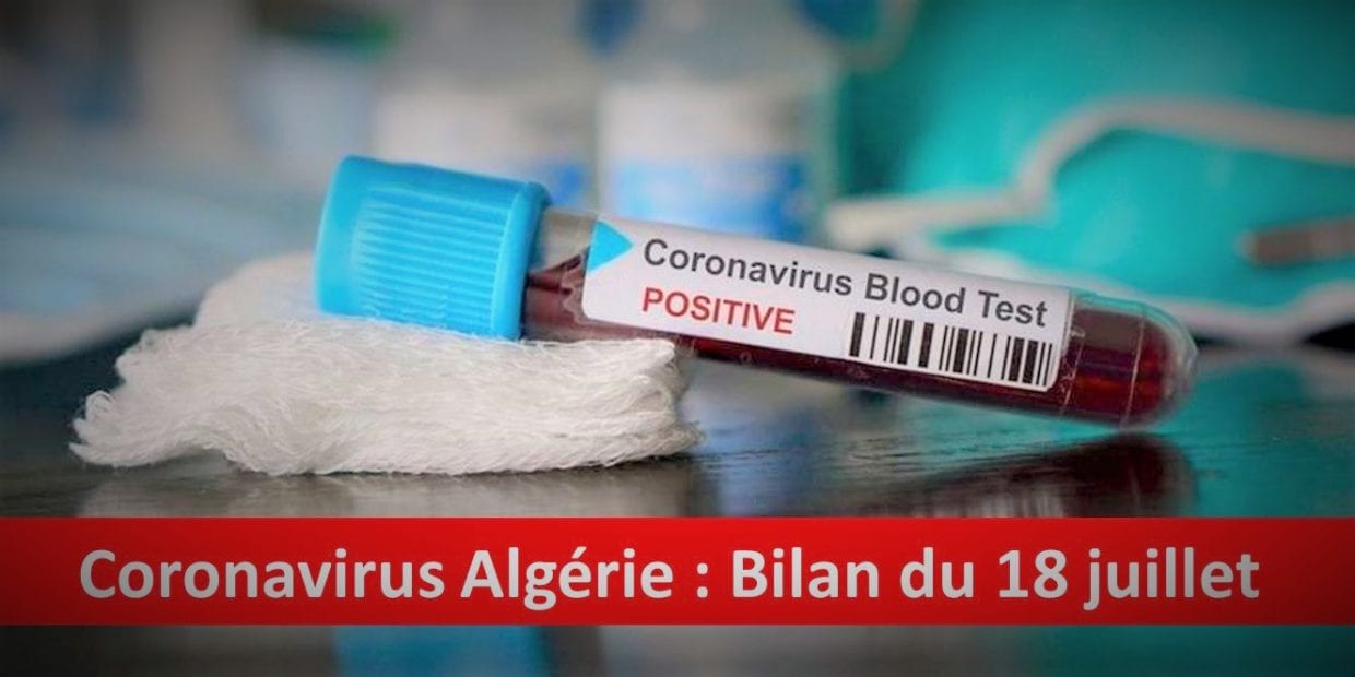 Bilan coronavirus du 18 juillet : Les guérisons en hausse