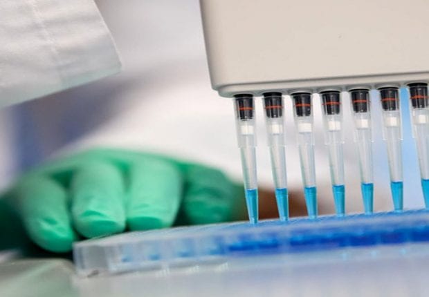 Constantine : Le laboratoire de dépistage inopérationnel à cause du manque d’équipements