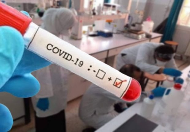 Dépistage coronavirus aux universités : les mises en gardes des spécialistes