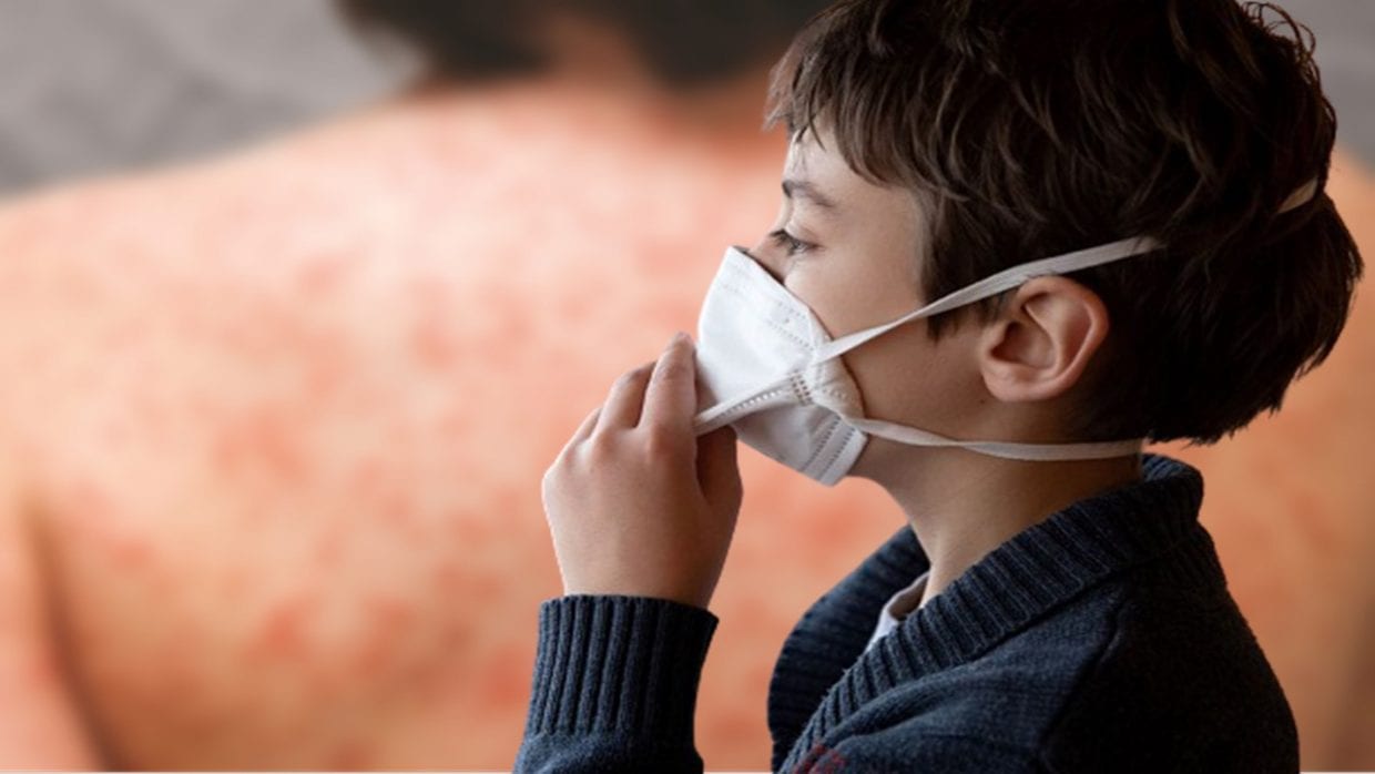 Sétif : Deux enfants positifs au Covid-19 seraient atteints de la maladie de Kawasaki  