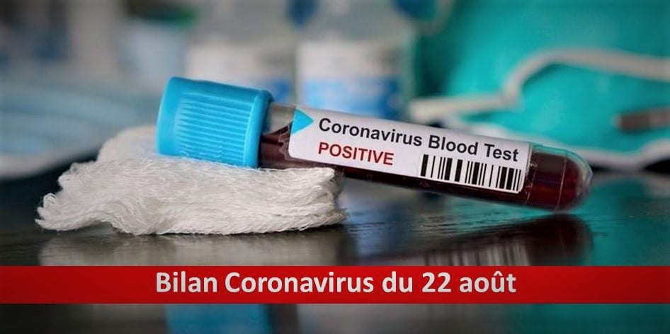 Bilan Coronavirus : Guérisons et décès de ce 22 août