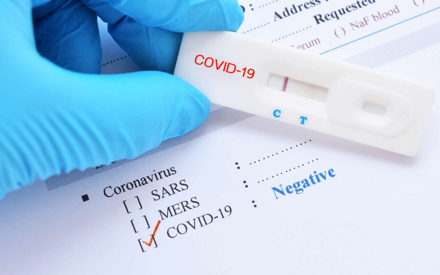 Coronavirus : Une clinique privée profite de la pandémie pour vendre des tests PCR à 18000 dinars !