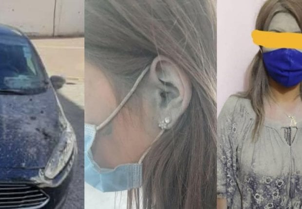 Alger : Une jeune femme se fait agresser pour une place de stationnement