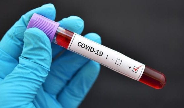 Coronavirus : 20 algériens testés positifs au covid-19 en Tunisie