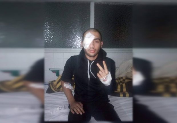 Manifestation du samedi dernier : Un jeune manifestant perd son œil à Bouira (CNLD)