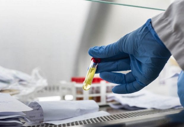 Coronavirus Algérie : Acquisition prochaine de tests « antigènes »