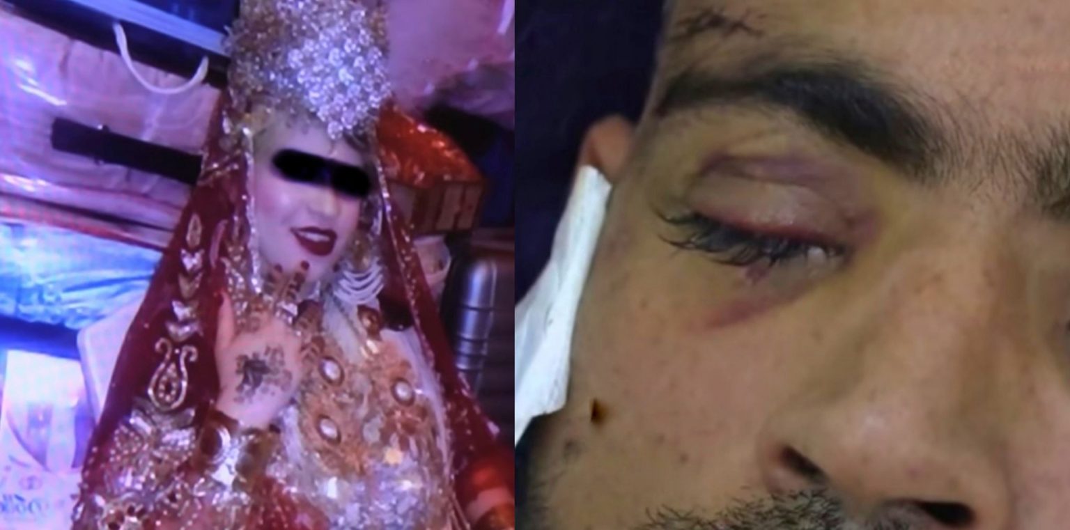 Sidi Bel Abbès : Elle arrache les yeux de son mari lors de leur première nuit de noce