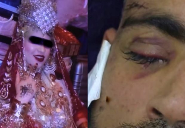 Sidi Bel Abbès : Elle arrache les yeux de son mari lors de leur première nuit de noce