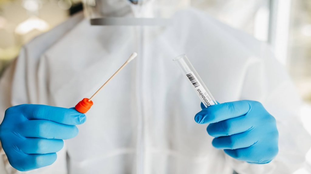 Coronavirus Algérie : Les résultats des tests PCR effectués chez le privé remis en doute