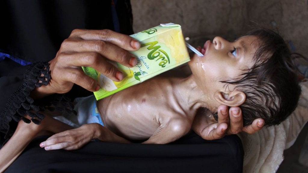 Le Yémen face au « danger imminent de la pire famine au monde » (ONU) 