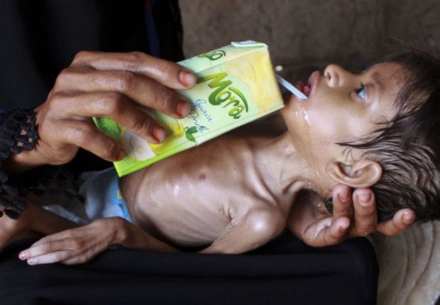 Le Yémen face au « danger imminent de la pire famine au monde » (ONU) 