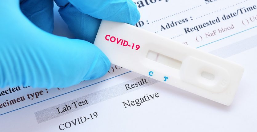 Covid-19 : où en est la situation épidémique en Algérie ?
