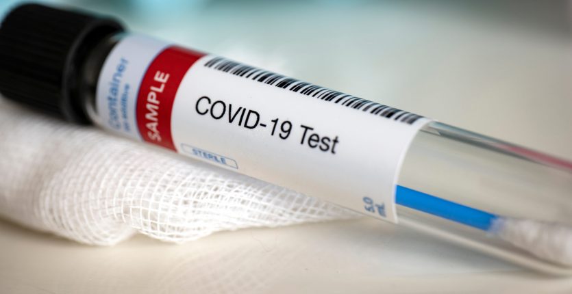 Bilan Covid-19 : le nombre de cas repasse sous les 10 ce 18 octobre