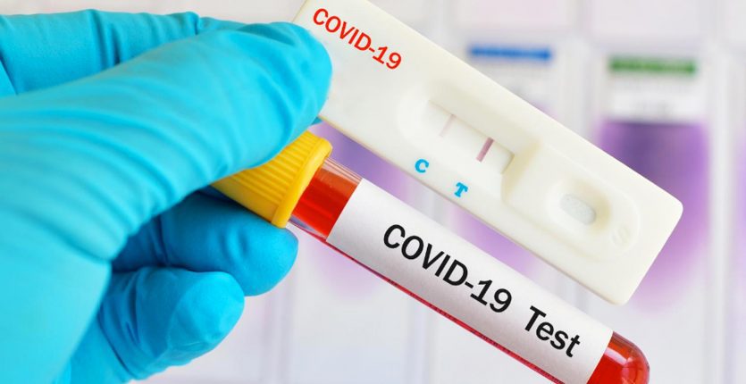 Bilan Covid-19 : nombre de cas en léger recul ce lundi 8 aout