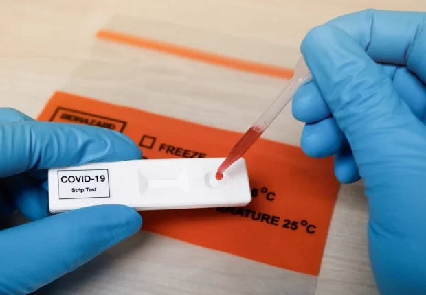 Bilan Covid-19 : légère baisse du nombre de cas ce 20 octobre