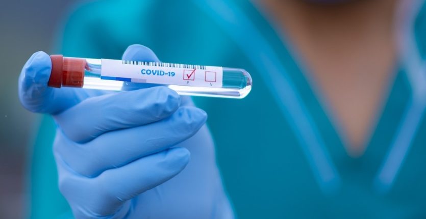 Bilan Covid-19 : le nombre de cas repart à la baisse ce 16 novembre