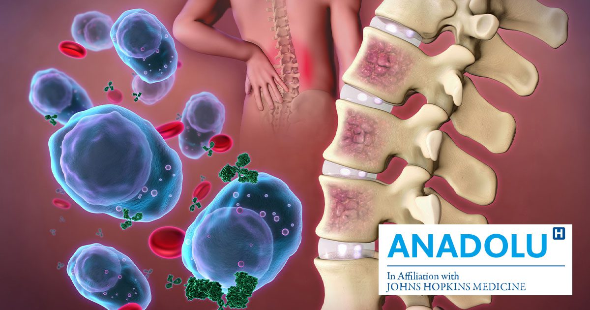 "Understanding Multiple Myeloma Symptoms, Treatment, and Bone Marrow