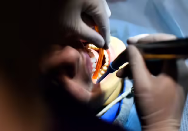 L&rsquo;Ordre des médecins dentistes tire la sonnette d&rsquo;alarme : STOP aux « faux-prothésistes » ! 