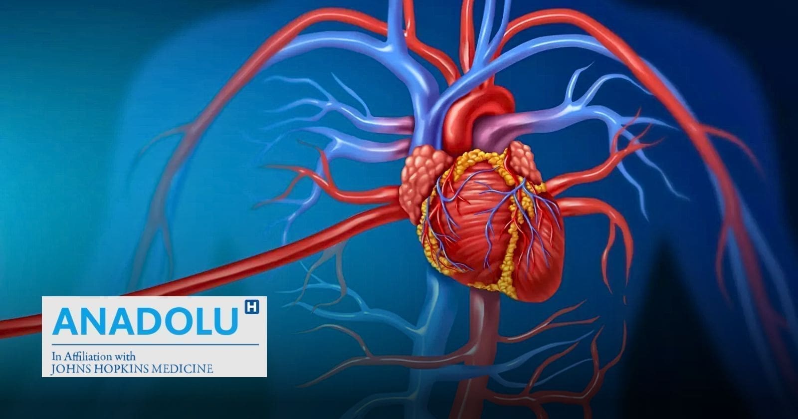 Angioscanner cardiaque : Qui peut bénéficier de cet examen crucial ?