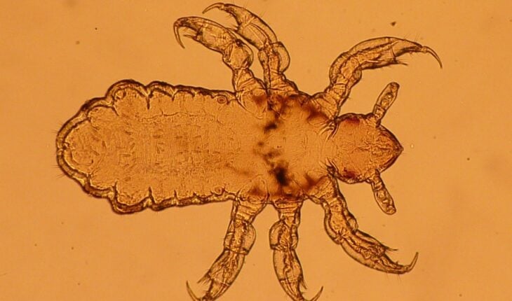 larva, lice, insect, parasite, lice, lice, lice, lice, lice, parasite