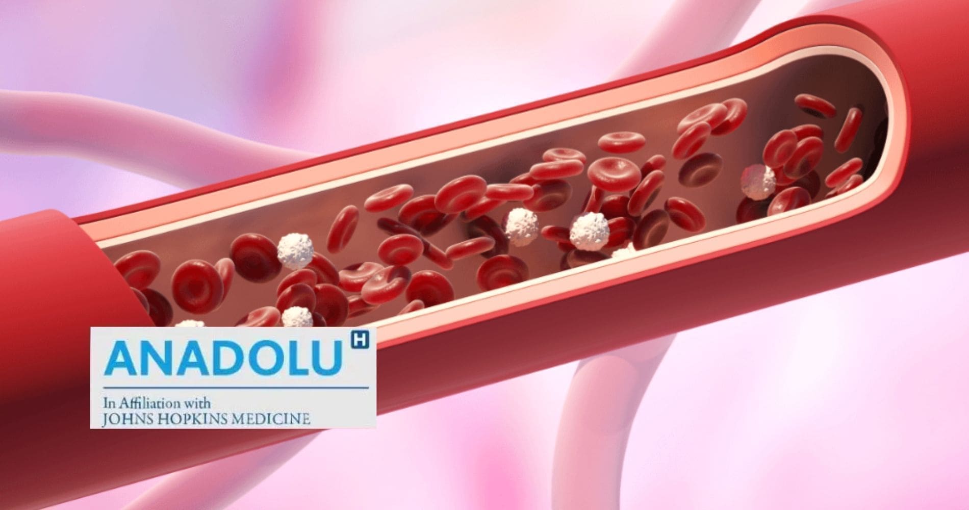 Angiographie : comprendre l’examen clé pour diagnostiquer et traiter les maladies cardiaques
