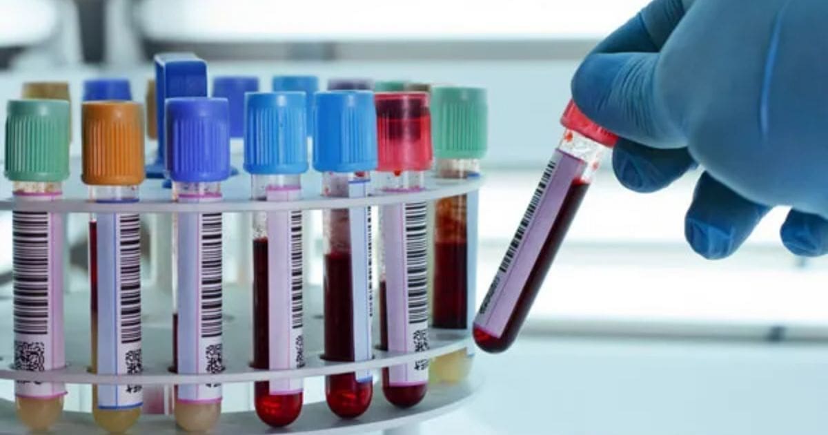 Analyses médicales en Algérie : le coup de pression du SALAM