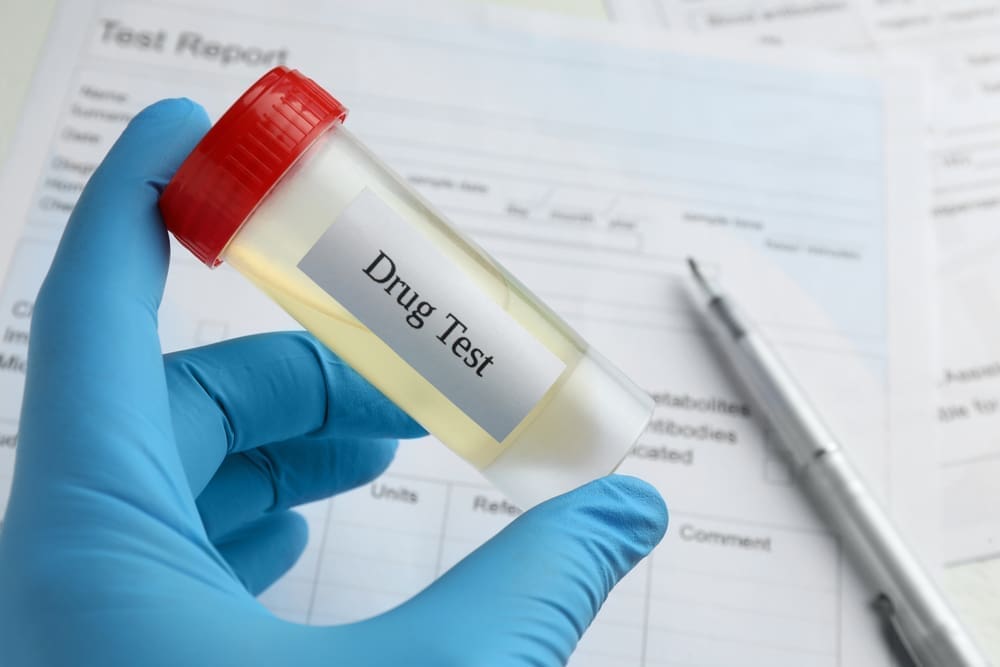 Nouvelle loi pour l’emploi en Algérie : le test anti-drogue devient obligatoire