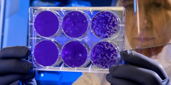 Hantavirus sur un bateau de croisière, 3 décès : pourquoi les experts s’inquiètent